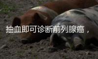 抽血即可诊断前列腺癌

，拜登为何不测�？