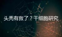 头秃有救了
？干细胞研究阐明压力如何影响毛发生长