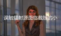 误触辐射源面临截肢的小伙
：“活着需要很大的勇气”丨记者手记